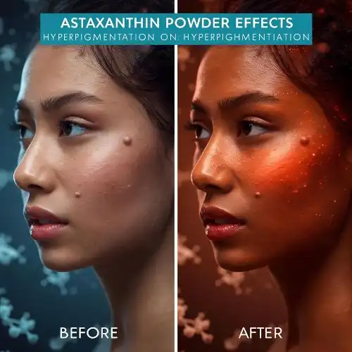 Astaxanthin Powder Effects on Hyperpigmentation