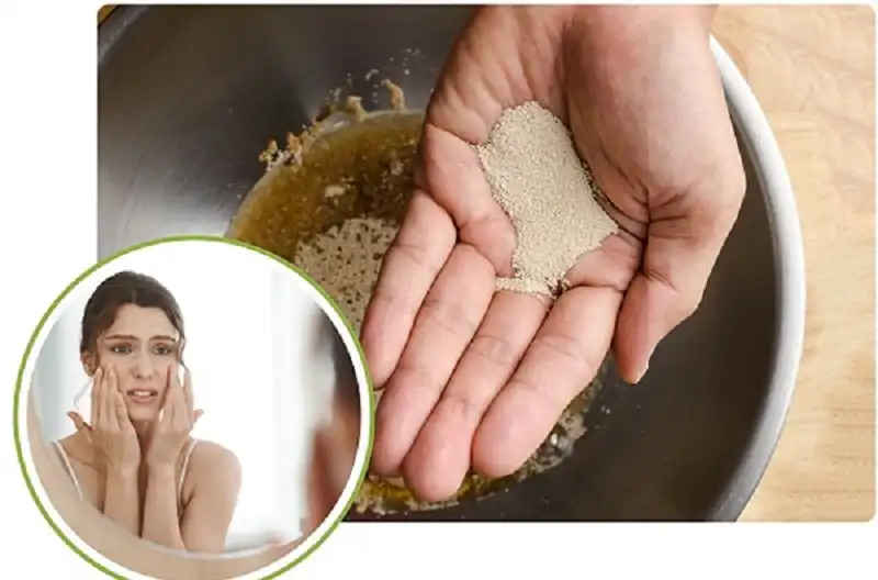 yeast extract environmental stress yeast extract environmental stress